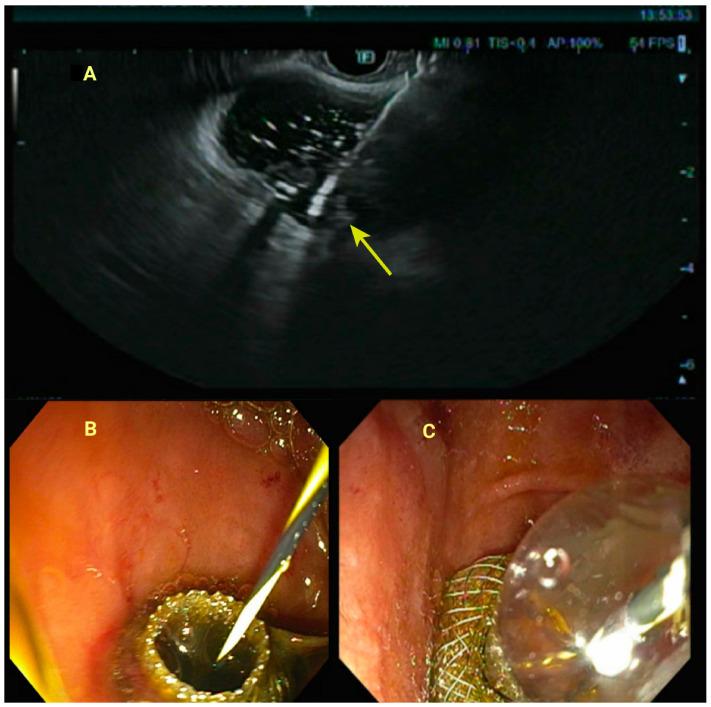 https://cdn.ncbi.nlm.nih.gov/pmc/blobs/b522/11766296/4835d1094c52/jcm-14-00494-g002.jpg