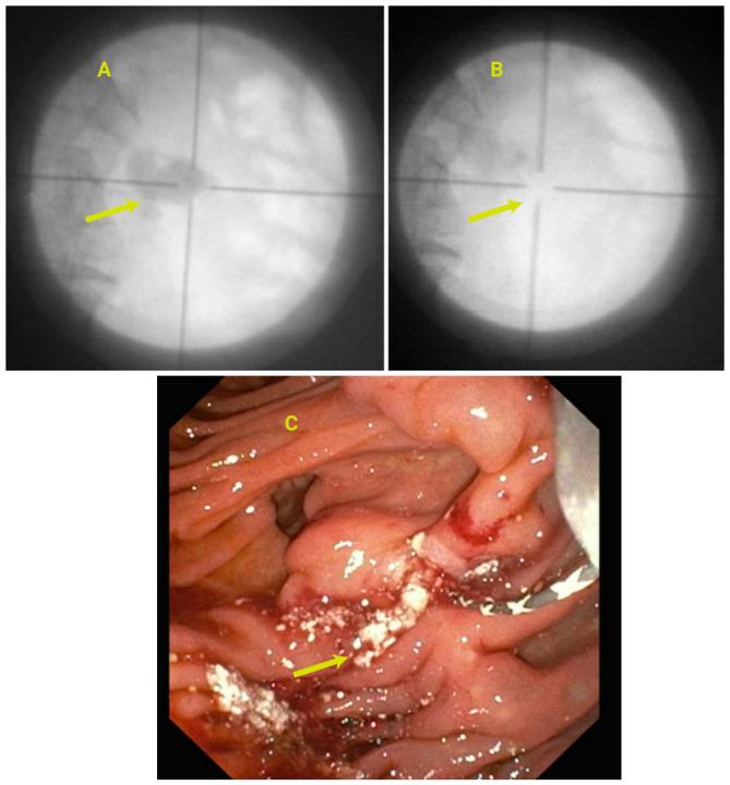 https://cdn.ncbi.nlm.nih.gov/pmc/blobs/b522/11766296/cda90c0d9677/jcm-14-00494-g009.jpg