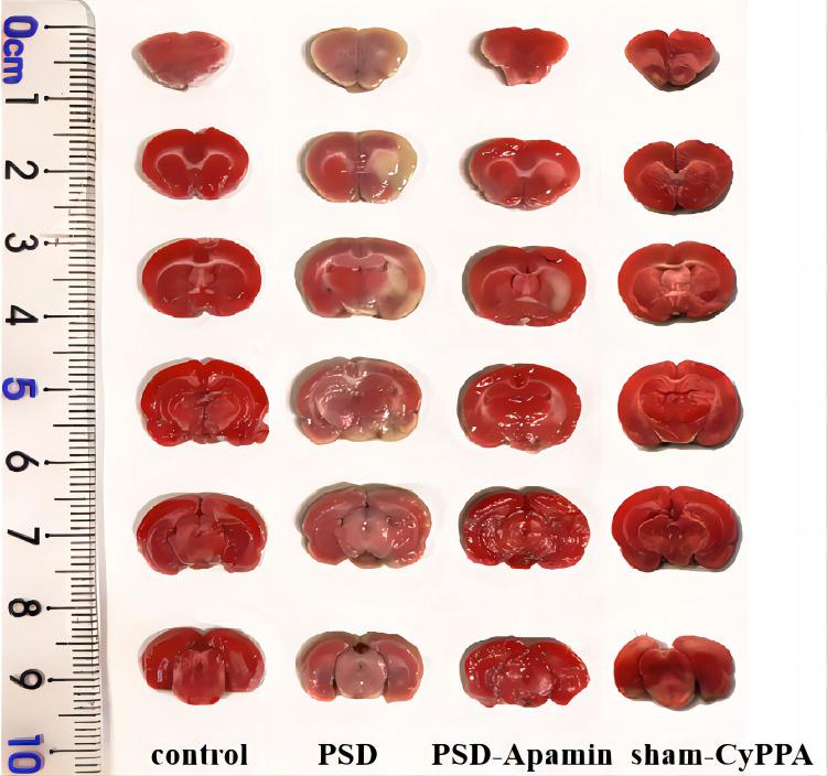 https://cdn.ncbi.nlm.nih.gov/pmc/blobs/b529/10572402/2b4c18b95e2c/NDT-19-2127-g0003.jpg