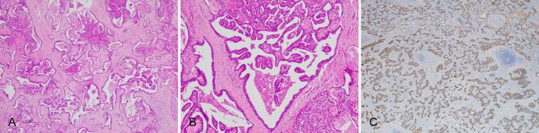 https://cdn.ncbi.nlm.nih.gov/pmc/blobs/b529/10752808/71225e3429e7/JCTH-11-1553-g006.jpg