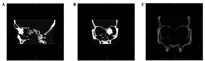 https://cdn.ncbi.nlm.nih.gov/pmc/blobs/b531/3678544/1b78366d7239/OL-05-05-1724-g00.jpg