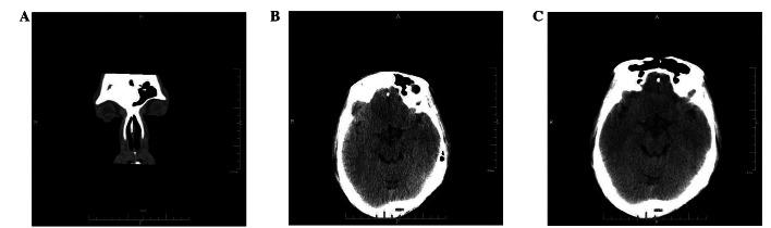 https://cdn.ncbi.nlm.nih.gov/pmc/blobs/b531/3678544/c309e52355ca/OL-05-05-1724-g01.jpg