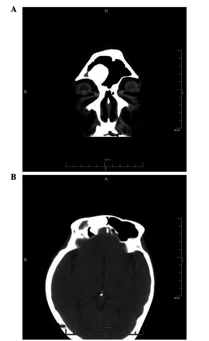 https://cdn.ncbi.nlm.nih.gov/pmc/blobs/b531/3678544/dc19898444fc/OL-05-05-1724-g02.jpg