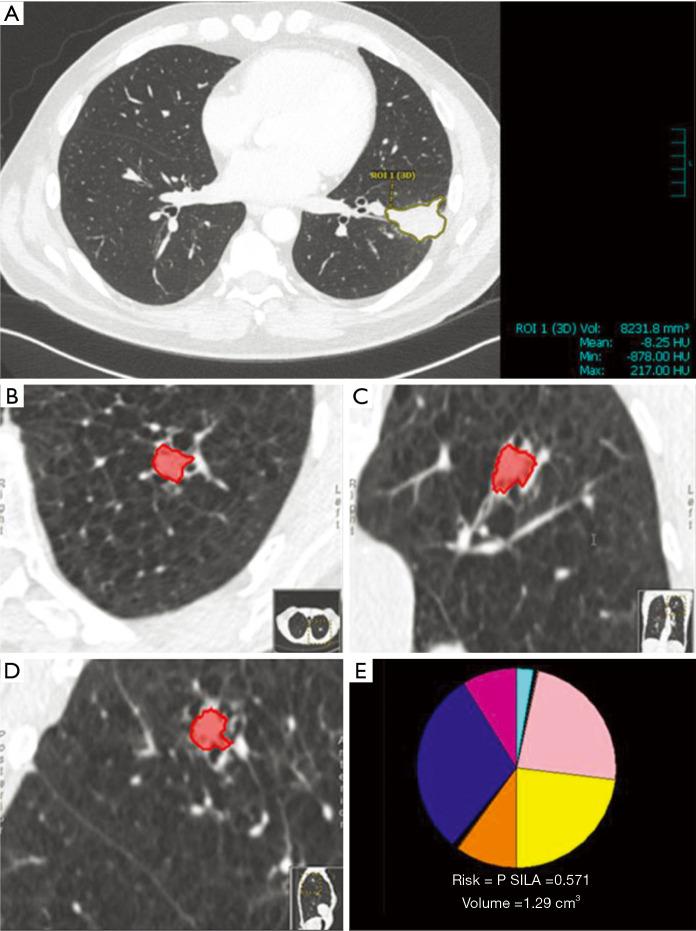 https://cdn.ncbi.nlm.nih.gov/pmc/blobs/b533/7711402/93ea1cbaedfb/jtd-12-11-6966-f2.jpg