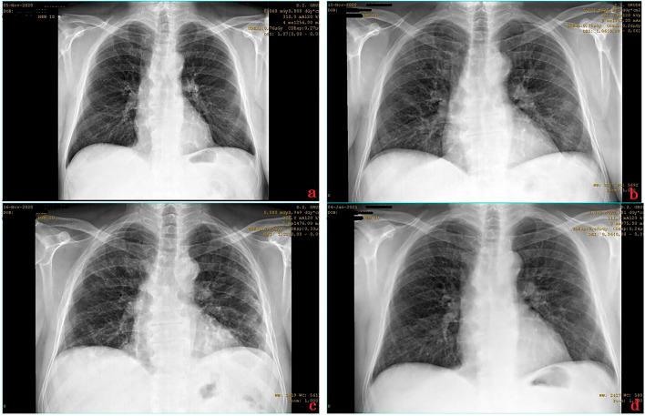 https://cdn.ncbi.nlm.nih.gov/pmc/blobs/b537/8387596/6917b3346f5e/fphar-12-684537-g003.jpg