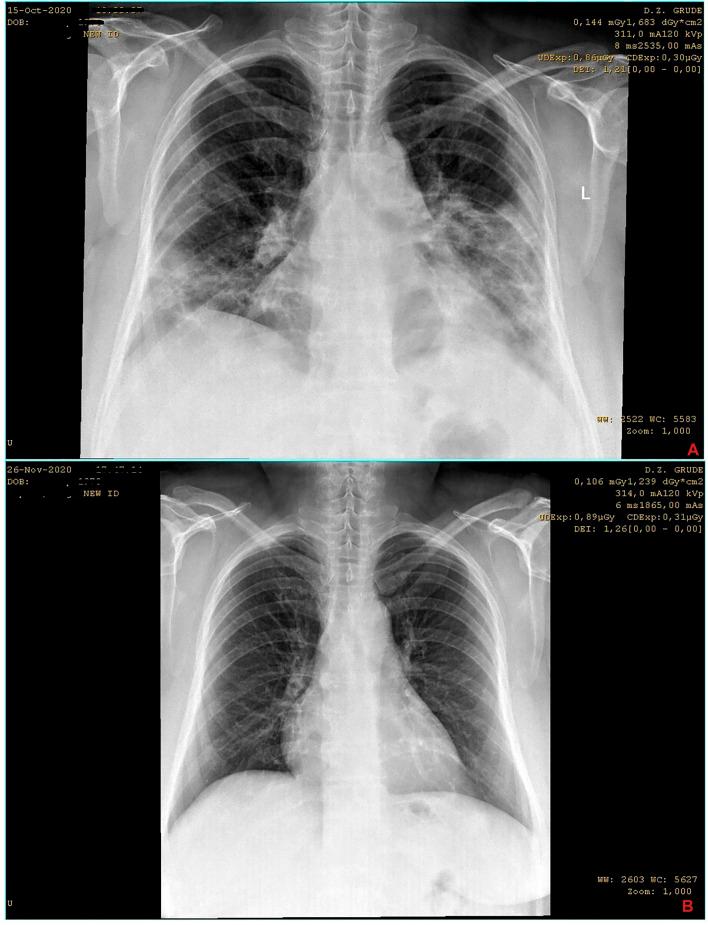 https://cdn.ncbi.nlm.nih.gov/pmc/blobs/b537/8387596/fa8d2d91e0f8/fphar-12-684537-g002.jpg