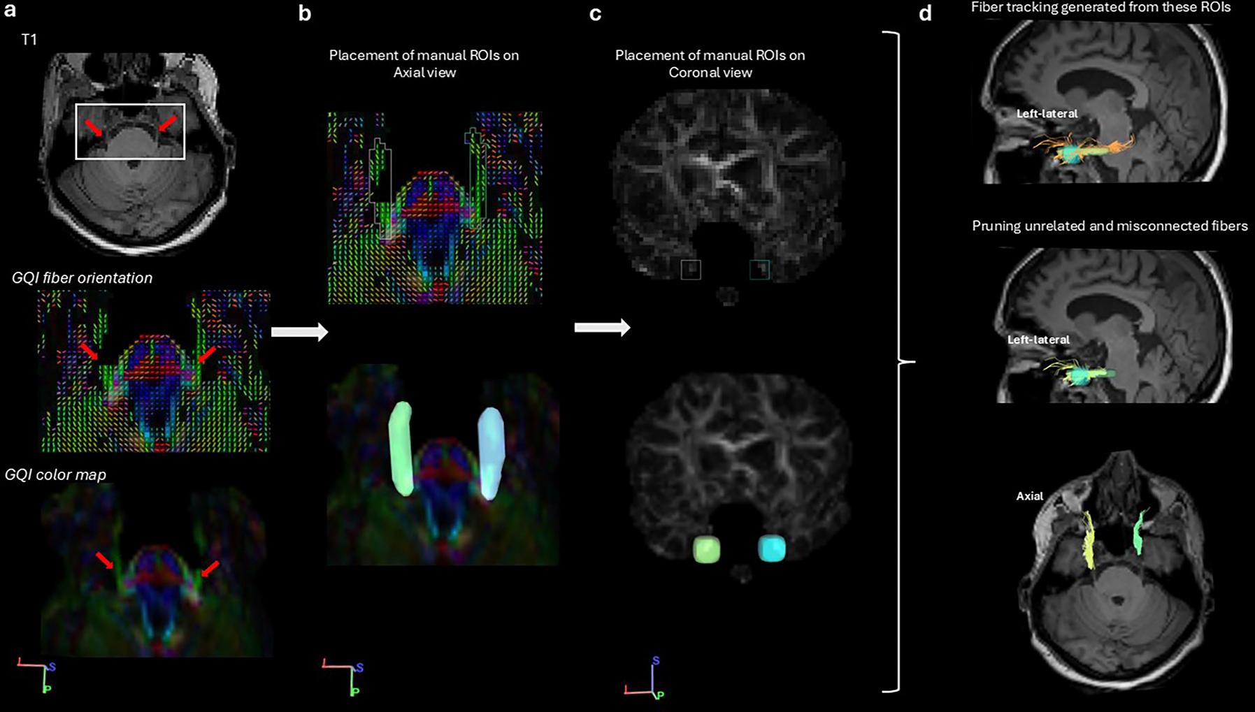 https://cdn.ncbi.nlm.nih.gov/pmc/blobs/b538/12356230/b44c24aa9034/nihms-2100748-f0001.jpg