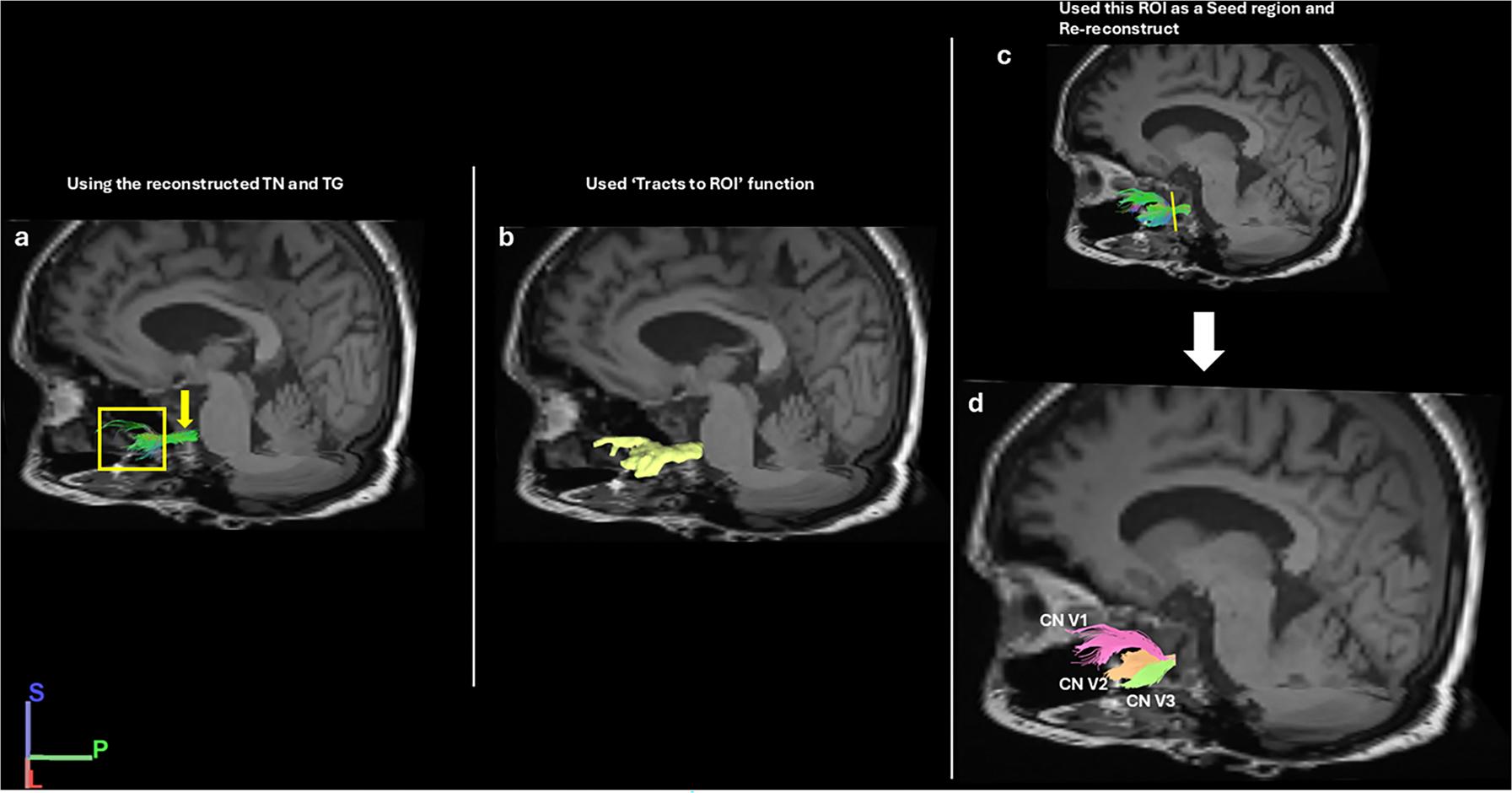 https://cdn.ncbi.nlm.nih.gov/pmc/blobs/b538/12356230/c0009562db3a/nihms-2100748-f0003.jpg
