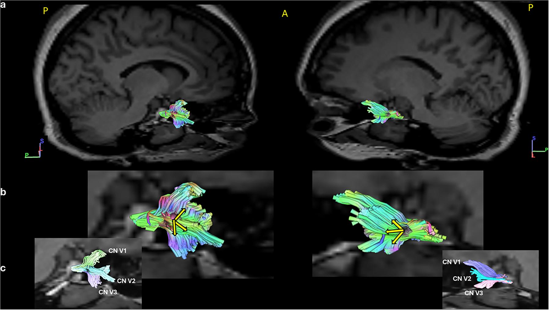 https://cdn.ncbi.nlm.nih.gov/pmc/blobs/b538/12356230/d97006ad7464/nihms-2100748-f0004.jpg