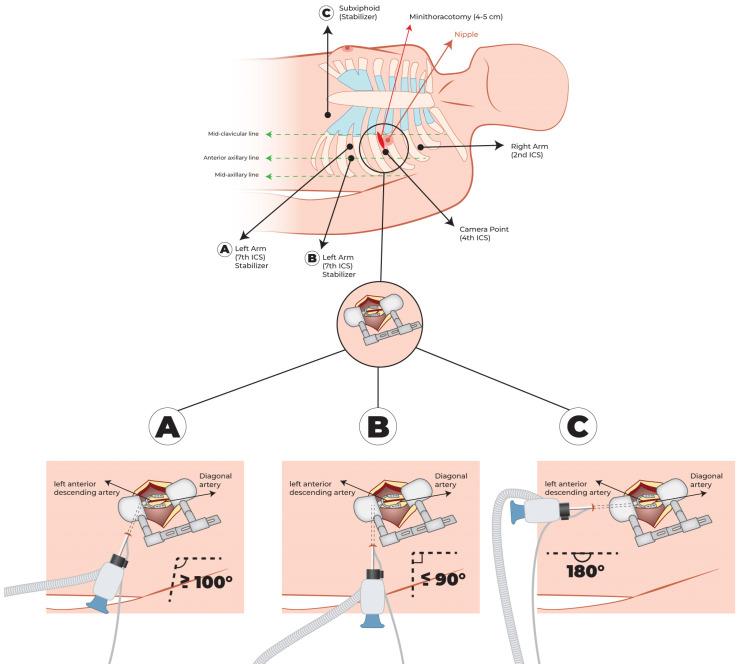 https://cdn.ncbi.nlm.nih.gov/pmc/blobs/b540/11051288/fb83b1fe52ed/jcm-13-02435-g002.jpg
