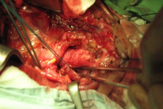 https://cdn.ncbi.nlm.nih.gov/pmc/blobs/b541/4316129/ab8b6ca94e4f/JMedLife-07-516-g006.jpg