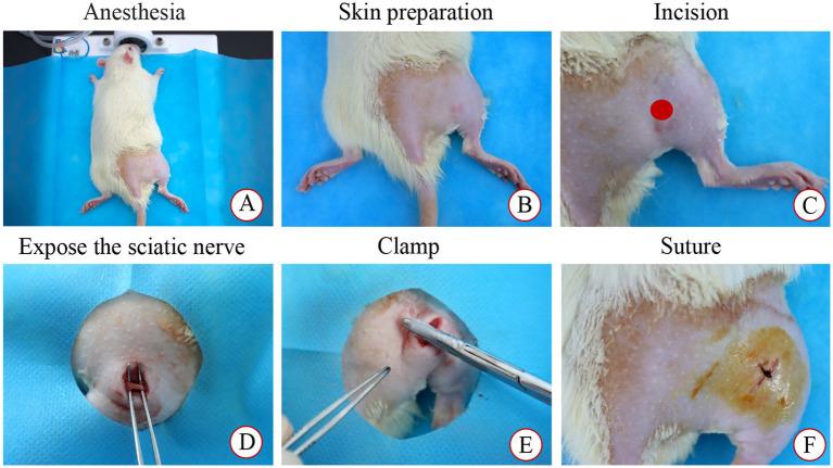 https://cdn.ncbi.nlm.nih.gov/pmc/blobs/b547/12344559/e31b06ede8f2/fneur-16-1622602-g001.jpg