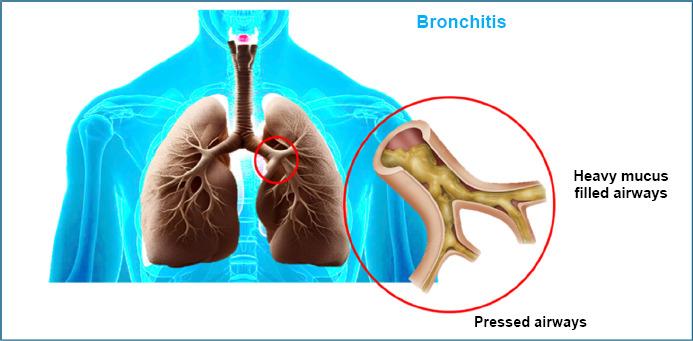 https://cdn.ncbi.nlm.nih.gov/pmc/blobs/b54e/12046236/345fb1bc0667/TORMJ-19-E18743064341009_F8.jpg