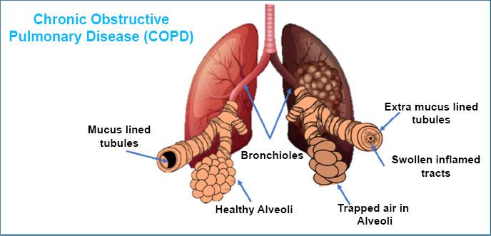 https://cdn.ncbi.nlm.nih.gov/pmc/blobs/b54e/12046236/638fdf40619d/TORMJ-19-E18743064341009_F5.jpg