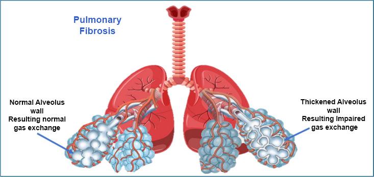https://cdn.ncbi.nlm.nih.gov/pmc/blobs/b54e/12046236/e0d092ea551a/TORMJ-19-E18743064341009_F2.jpg