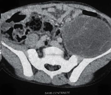 https://cdn.ncbi.nlm.nih.gov/pmc/blobs/b54f/8590589/2281399c32fc/CRIPE2021-1961509.001.jpg