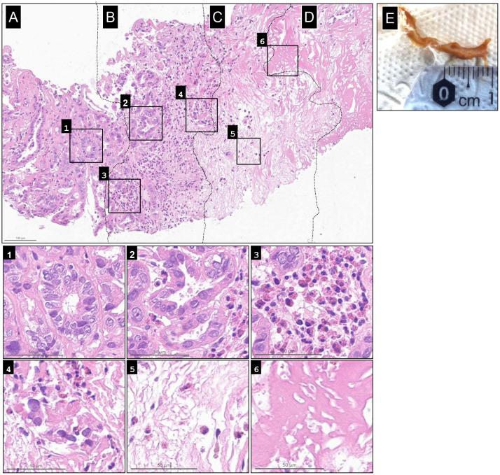 https://cdn.ncbi.nlm.nih.gov/pmc/blobs/b553/12368778/69fcd3e1b83f/fonc-15-1631155-g004.jpg