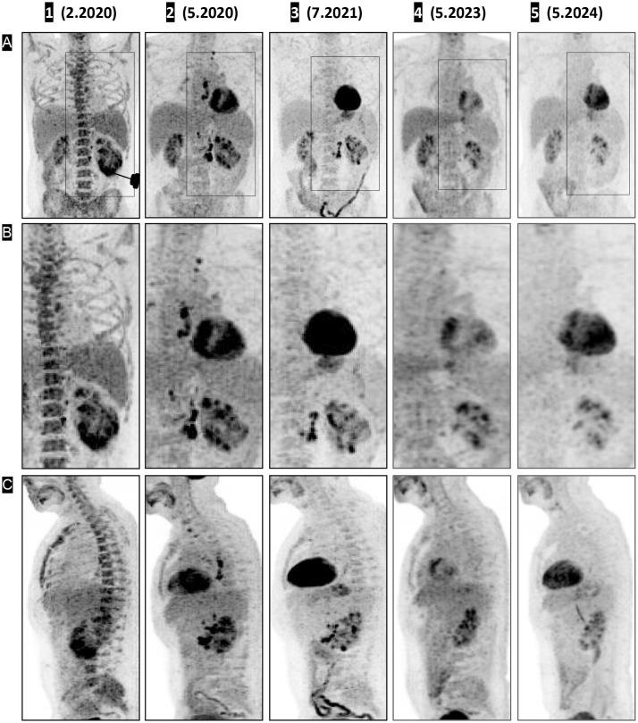 https://cdn.ncbi.nlm.nih.gov/pmc/blobs/b553/12368778/bdb90b768a0c/fonc-15-1631155-g001.jpg