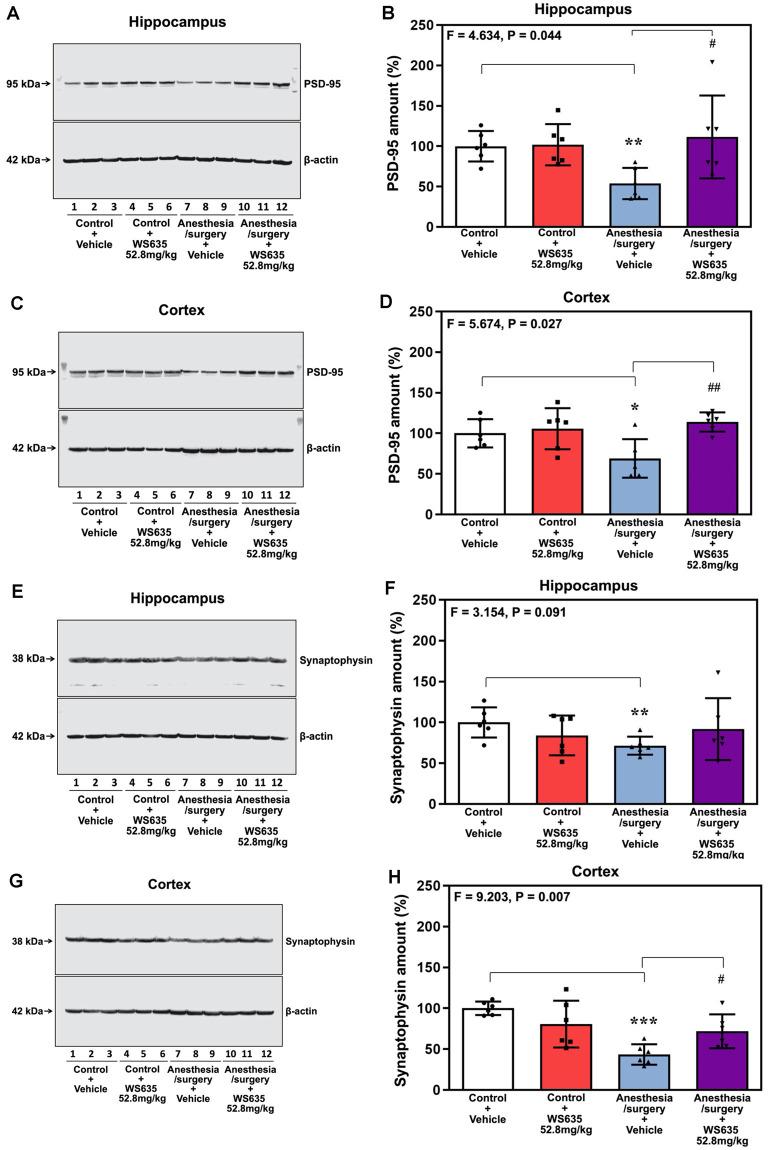 https://cdn.ncbi.nlm.nih.gov/pmc/blobs/b554/8335586/b2475ea10bc7/fnagi-13-688587-g0006.jpg