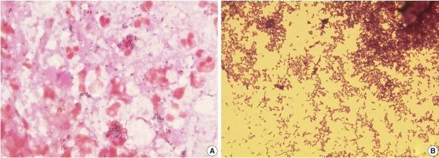 https://cdn.ncbi.nlm.nih.gov/pmc/blobs/b557/3116000/5397b17616b7/kjlm-31-122-g001.jpg