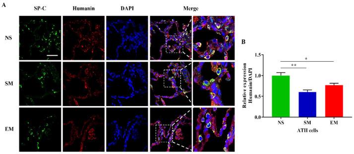 https://cdn.ncbi.nlm.nih.gov/pmc/blobs/b557/9313339/3f99da768f86/biomedicines-10-01497-g005.jpg