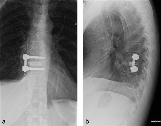 https://cdn.ncbi.nlm.nih.gov/pmc/blobs/b55c/3609007/a62c0d4b7492/ebsj01021-6.jpg