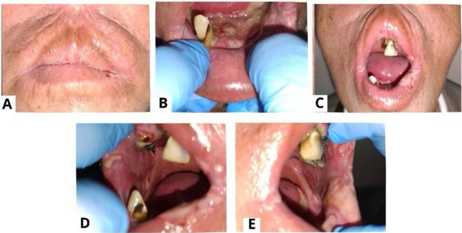 https://cdn.ncbi.nlm.nih.gov/pmc/blobs/b55f/12143291/41cb53dac79e/IMCRJ-18-663-g0002.jpg