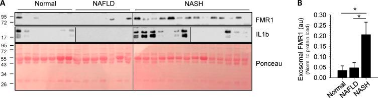 https://cdn.ncbi.nlm.nih.gov/pmc/blobs/b567/7659717/62dac36dce25/JCB_201912074_Fig5.jpg