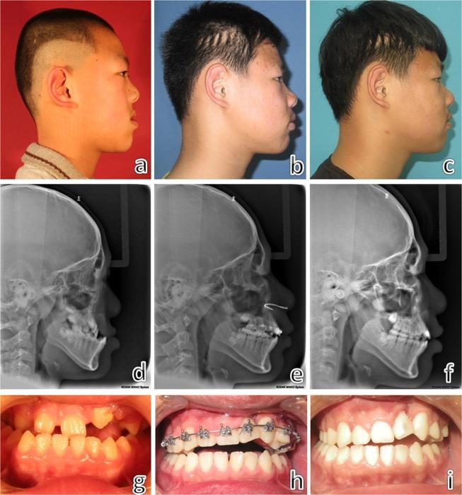 https://cdn.ncbi.nlm.nih.gov/pmc/blobs/b568/6351653/a10224bef7eb/41598_2018_37326_Fig5_HTML.jpg