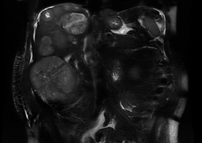 https://cdn.ncbi.nlm.nih.gov/pmc/blobs/b56f/6389483/8e2b4ff17e79/CCR3-7-251-g001.jpg
