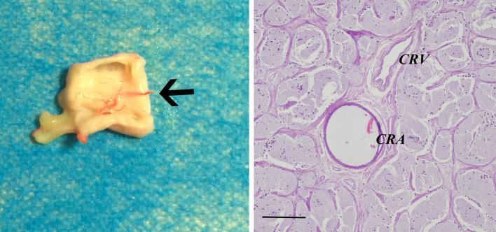 https://cdn.ncbi.nlm.nih.gov/pmc/blobs/b57b/7340666/eac3eb9f4c27/266_2019_1374_Fig3_HTML.jpg