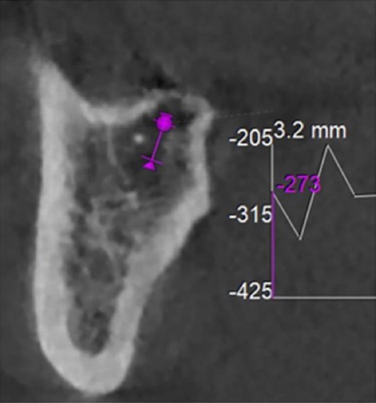 https://cdn.ncbi.nlm.nih.gov/pmc/blobs/b57c/9242433/7409466a1db0/IMCRJ-15-323-g0005.jpg