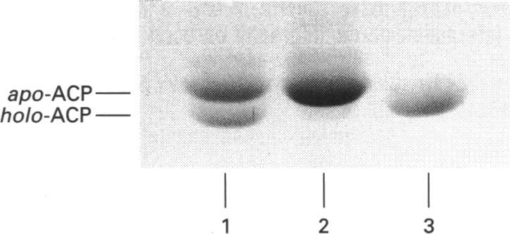https://cdn.ncbi.nlm.nih.gov/pmc/blobs/b580/1134486/de1f2b4d0478/biochemj00104-0214-b.jpg
