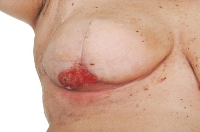 https://cdn.ncbi.nlm.nih.gov/pmc/blobs/b585/5357072/a5d32bc479ca/bctt-9-141Fig1.jpg