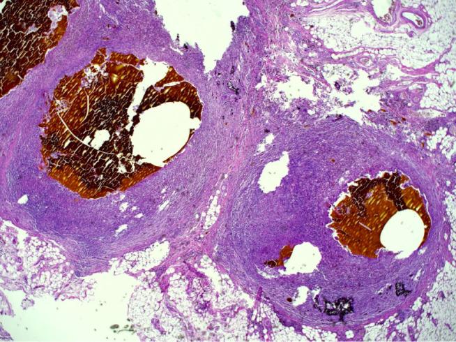 https://cdn.ncbi.nlm.nih.gov/pmc/blobs/b58d/10921212/82800562ef75/WJGS-16-622-g004.jpg