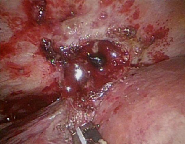 https://cdn.ncbi.nlm.nih.gov/pmc/blobs/b58d/10921212/f763d2f3e426/WJGS-16-622-g001.jpg