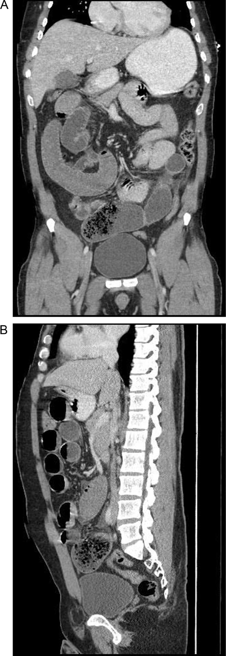 https://cdn.ncbi.nlm.nih.gov/pmc/blobs/b594/5198632/1a41aa7fa33e/gr2.jpg
