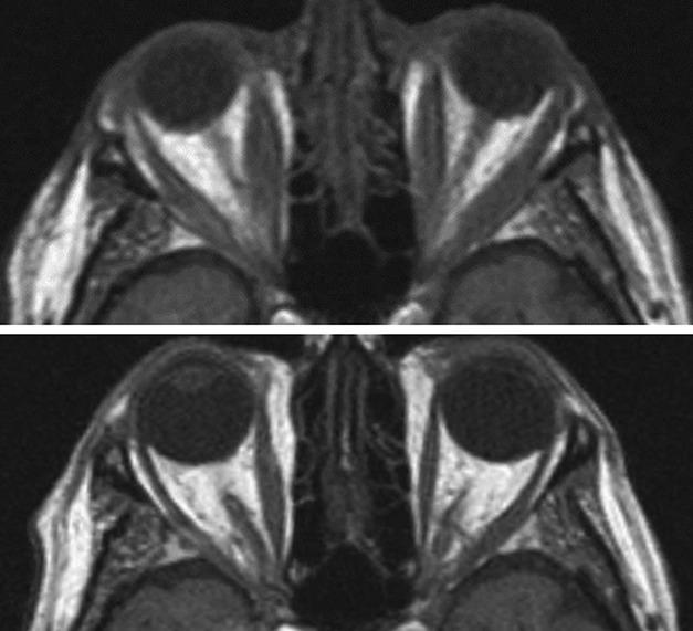 https://cdn.ncbi.nlm.nih.gov/pmc/blobs/b59a/10855992/fbf08b679e50/jno-44-074-g001.jpg