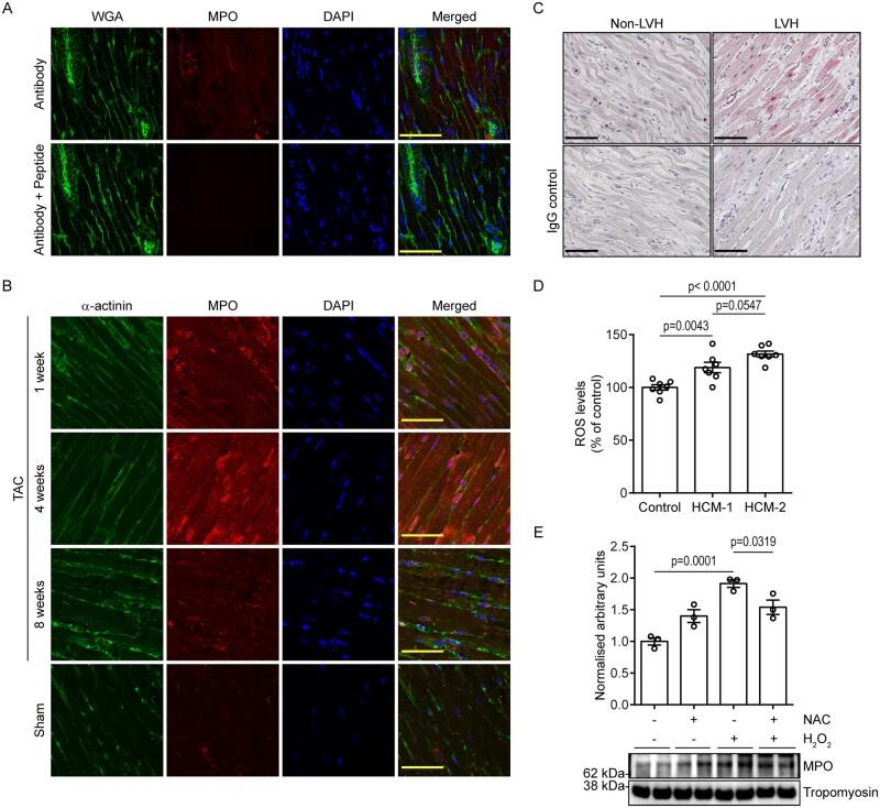 https://cdn.ncbi.nlm.nih.gov/pmc/blobs/b5af/8803077/965f7d6151a9/cvab077f4.jpg