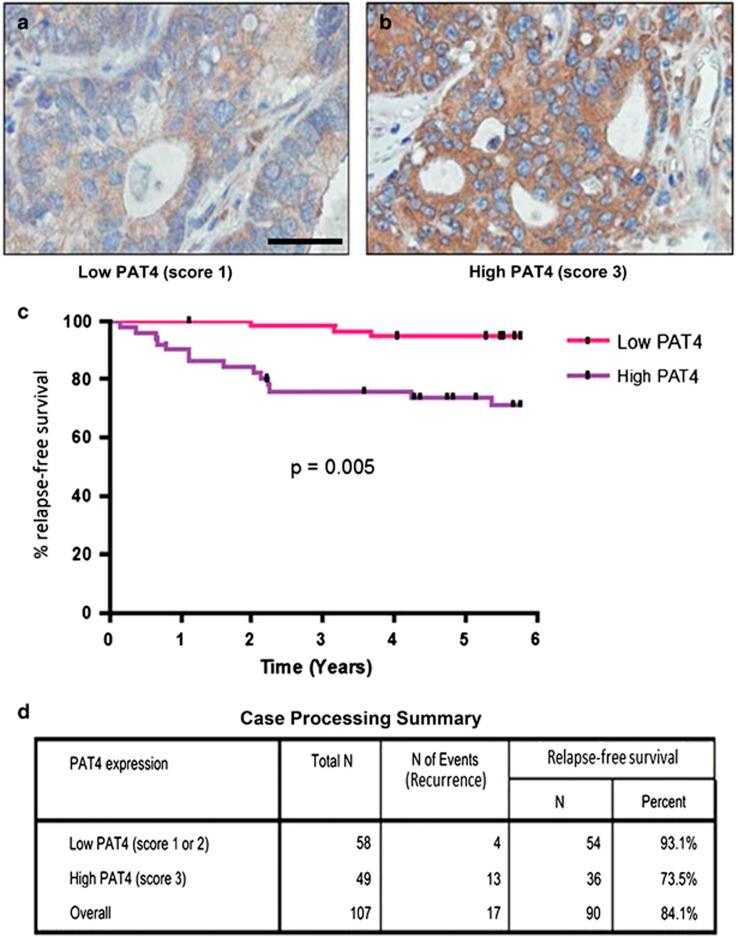 https://cdn.ncbi.nlm.nih.gov/pmc/blobs/b5b9/4908436/c239c5674366/onc2015363f2.jpg