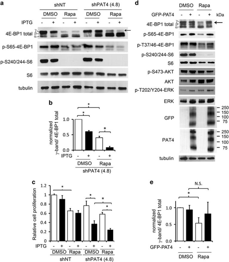 https://cdn.ncbi.nlm.nih.gov/pmc/blobs/b5b9/4908436/c5fefe71fd37/onc2015363f5.jpg