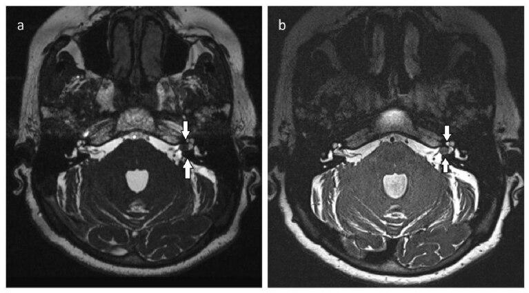 https://cdn.ncbi.nlm.nih.gov/pmc/blobs/b5b9/8283456/f9373f08b949/turkjmedsci-51-1123-fig002.jpg