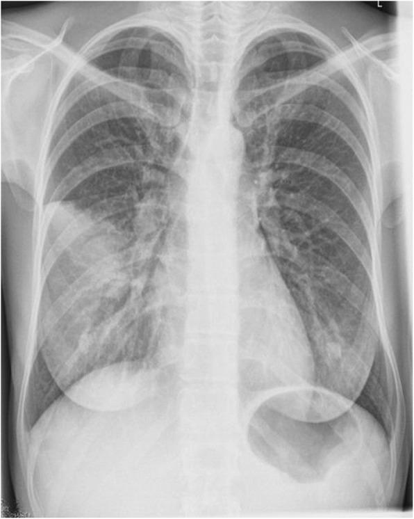 https://cdn.ncbi.nlm.nih.gov/pmc/blobs/b5ba/7048021/4c00eb78944c/12879_2020_4869_Fig2_HTML.jpg