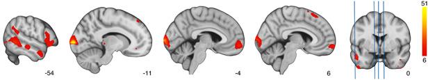 https://cdn.ncbi.nlm.nih.gov/pmc/blobs/b5bb/7647375/c02715730466/nsaa121f3.jpg