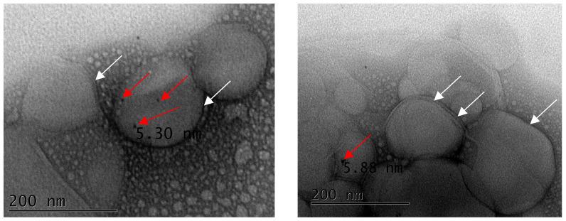 https://cdn.ncbi.nlm.nih.gov/pmc/blobs/b5cb/10458800/e6a89cd9d946/pharmaceutics-15-02162-g010.jpg