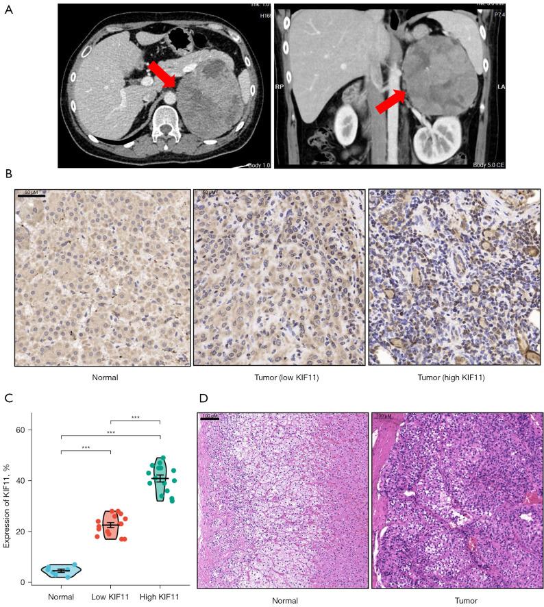 https://cdn.ncbi.nlm.nih.gov/pmc/blobs/b5d1/10170266/c4a7365336cf/tau-12-04-594-f2.jpg