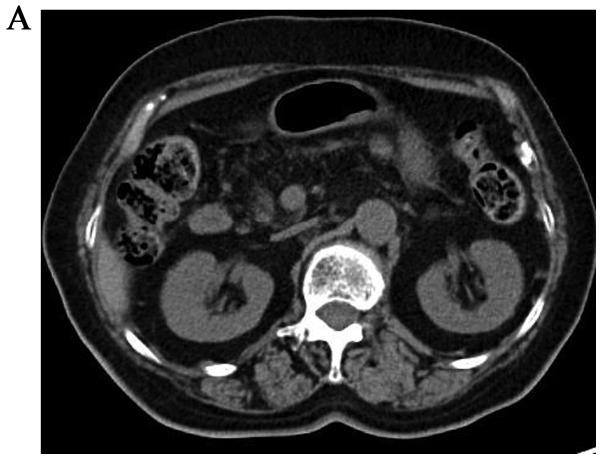 https://cdn.ncbi.nlm.nih.gov/pmc/blobs/b5d9/5795772/fa094eb2e82c/mco-08-03-0417-g05.jpg