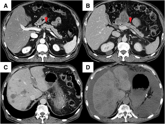 https://cdn.ncbi.nlm.nih.gov/pmc/blobs/b5dc/12377855/db658f78083f/scr-11-01-25-0156-g003.jpg