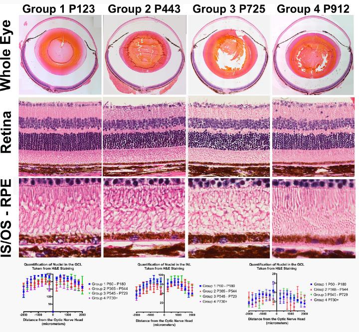 https://cdn.ncbi.nlm.nih.gov/pmc/blobs/b5de/8196434/90dc775b797a/iovs-62-7-9-f005.jpg