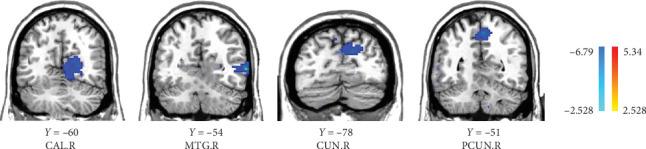 https://cdn.ncbi.nlm.nih.gov/pmc/blobs/b5e6/12283208/c446cd3af380/DA2025-7823251.001.jpg